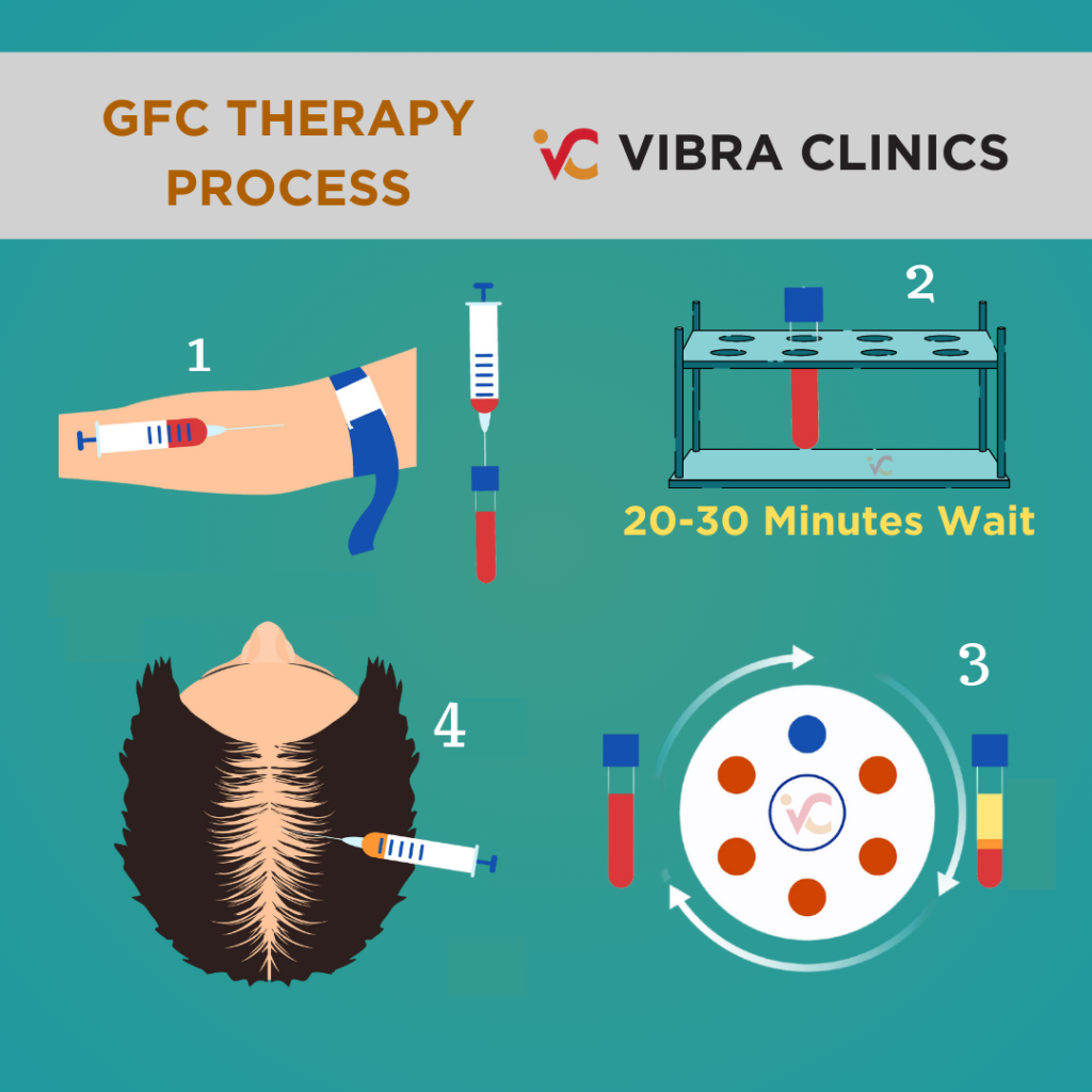 GFC Therapy in Udaipur For Hair Loss: Process Technique