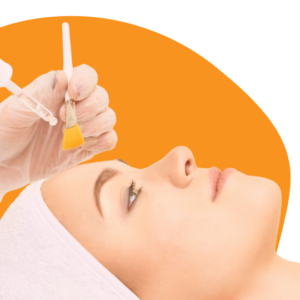 Chemical Peels Treatment Chemical Peel in Udaipur for Acne, Spots and Dull Skin