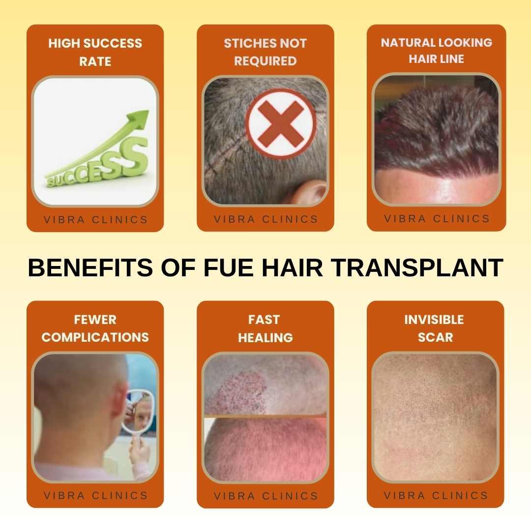 Benefits of FUE hair Transplant in Udaipur over FUT Hair Restoration