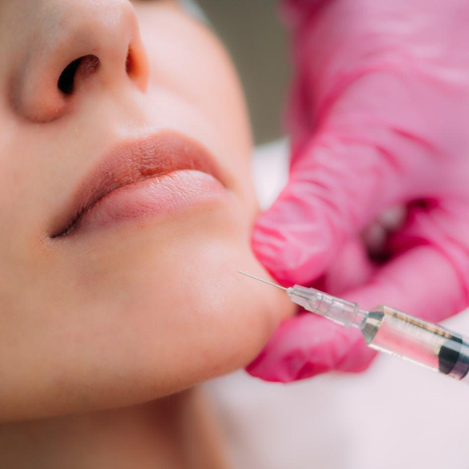 Woman receiving dermal filler treatment at Vibra Clinics, enhancing lips, jawline, and under-eye area for balanced, youthful volume