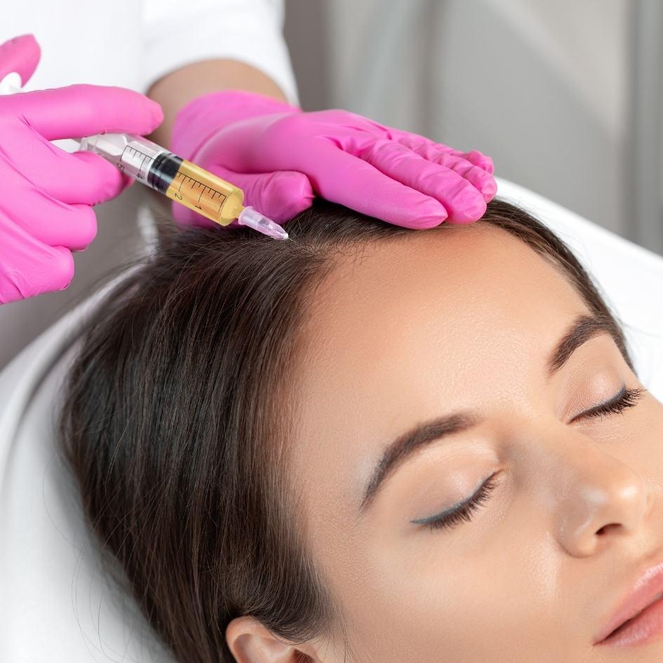 Close-up of Hair GFC Therapy being performed at Vibra Clinics to treat hair thinning and promote stronger regrowth.