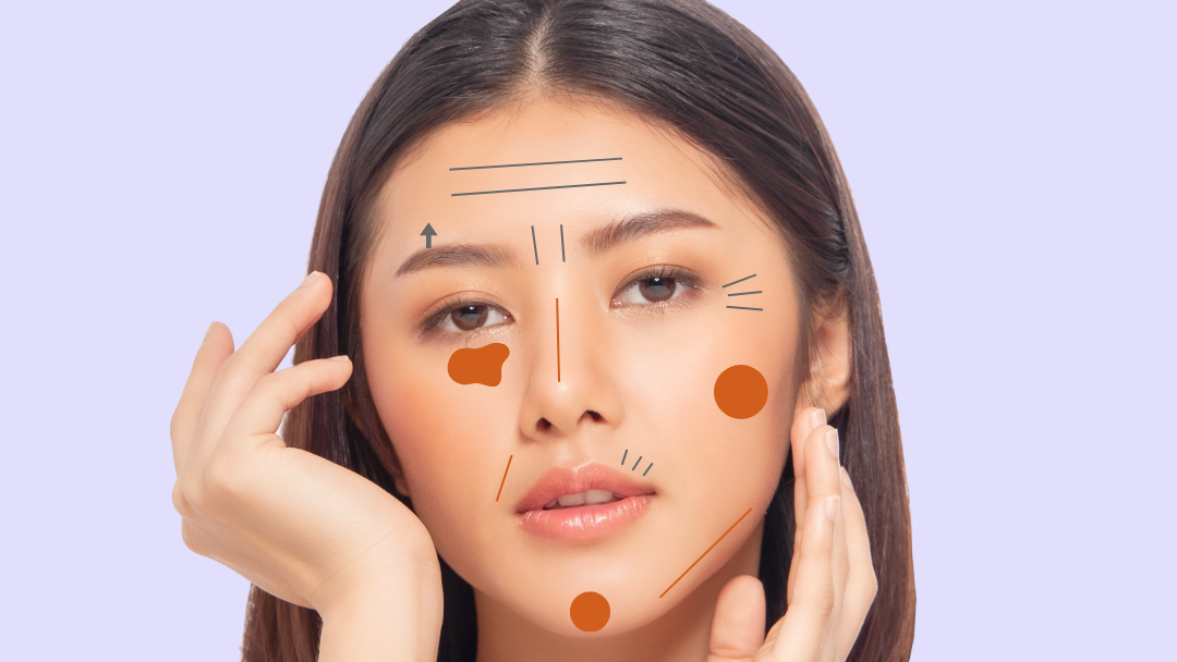 botox & fillers indications